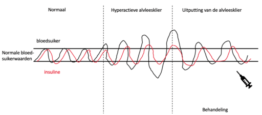 Diabetes Mellitus 2 insulinegevoeligheid